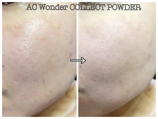 Ac ワンダーコレクトパウダー 36 写真共有サイト フォト蔵